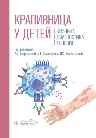 Крапивница у детей: клиника, диагностика, лечение фото книги