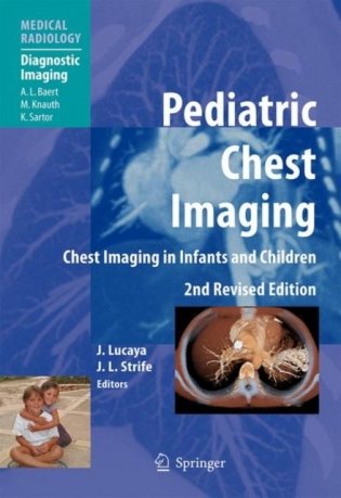 Pediatric Chest Imaging фото книги