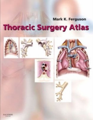 Thoracic Surgery Atlas фото книги
