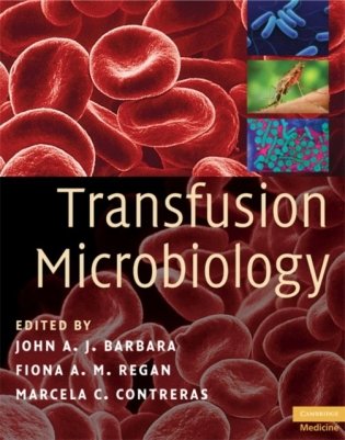 Transfusion Microbiology фото книги