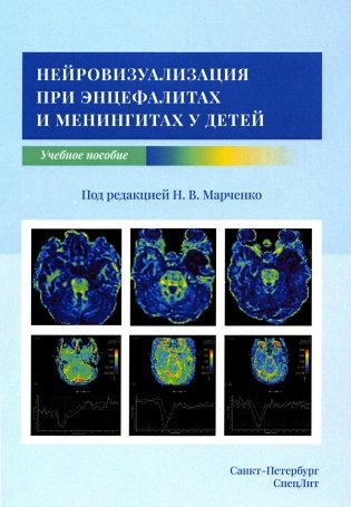 Нейровизуализация при энцефалитах и менингитах у детей фото книги