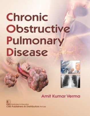 Chronic Obstructive Pulmonary Disease (Pb 2019) фото книги